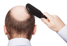 Does Creatine Cause hair loss?